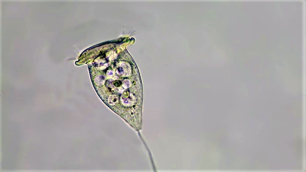 Vorticella Close Up 